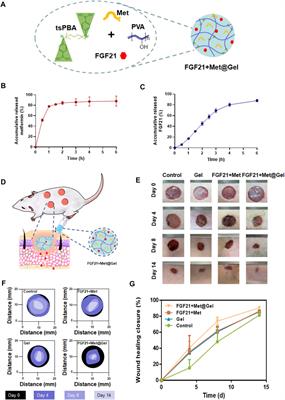 Adhesive, injectable, and ROS-responsive hybrid <mark class="highlighted">polyvinyl alcohol (PVA)</mark> hydrogel co-delivers metformin and fibroblast growth factor 21 (FGF21) for enhanced diabetic wound repair
